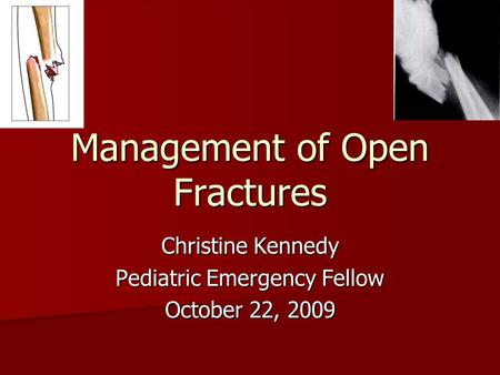 Management of Open Fractures Christine Kennedy Pediatric Emergency Fellow October 22, 2009.