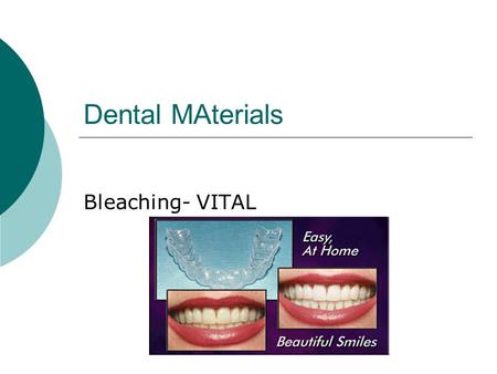 Dental MAterials Bleaching- VITAL 1. Describe the process of bleaching  3 techniques  In office (heat/light)  At Home (trays)  Over the counter 