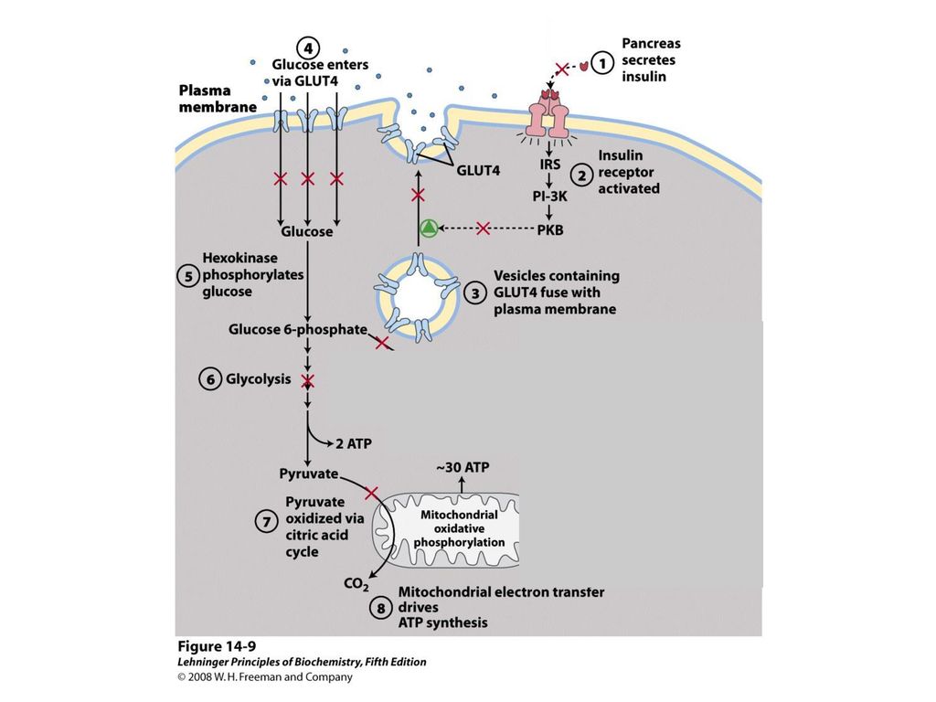 type 1 diabetes glucose metabolism