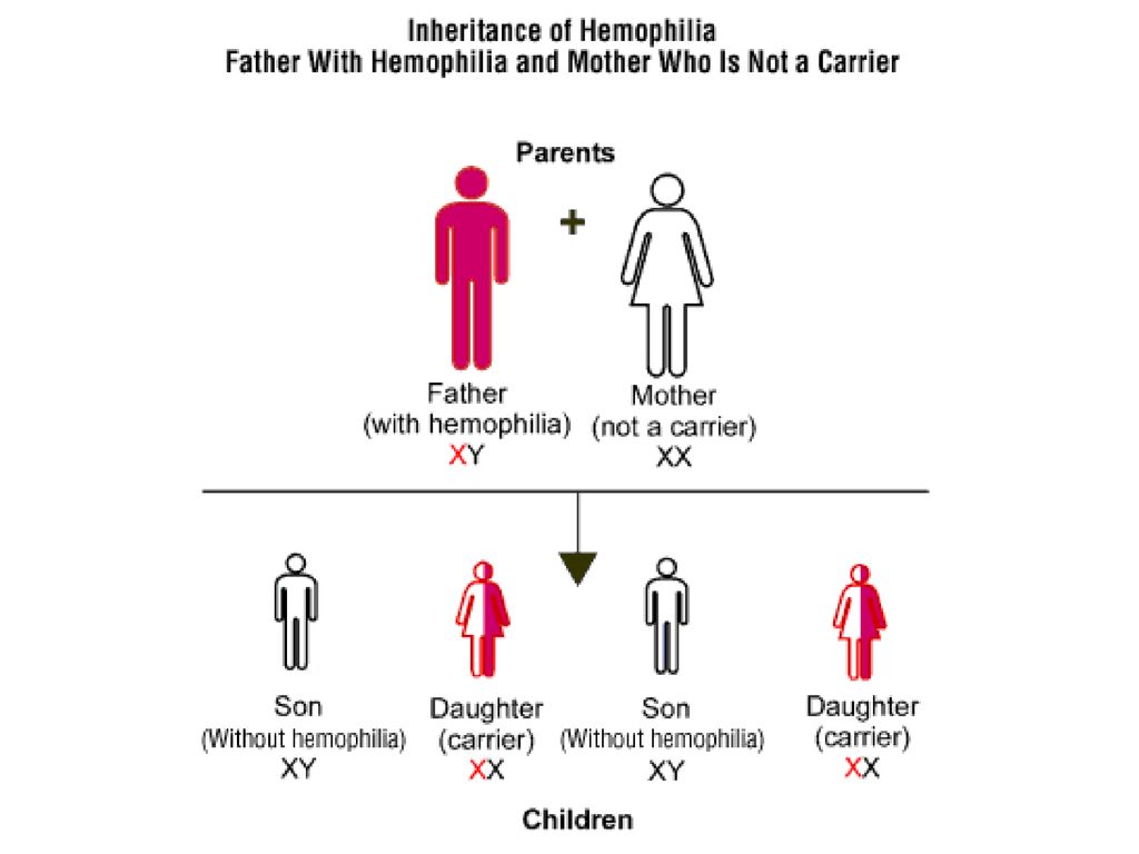 Генотип женщины страдающей гемофилией. Гемофилия клинические синдромы. Гемофилия этиология. Гемофилия у детей клиника. Гемофилия симптомы у детей.