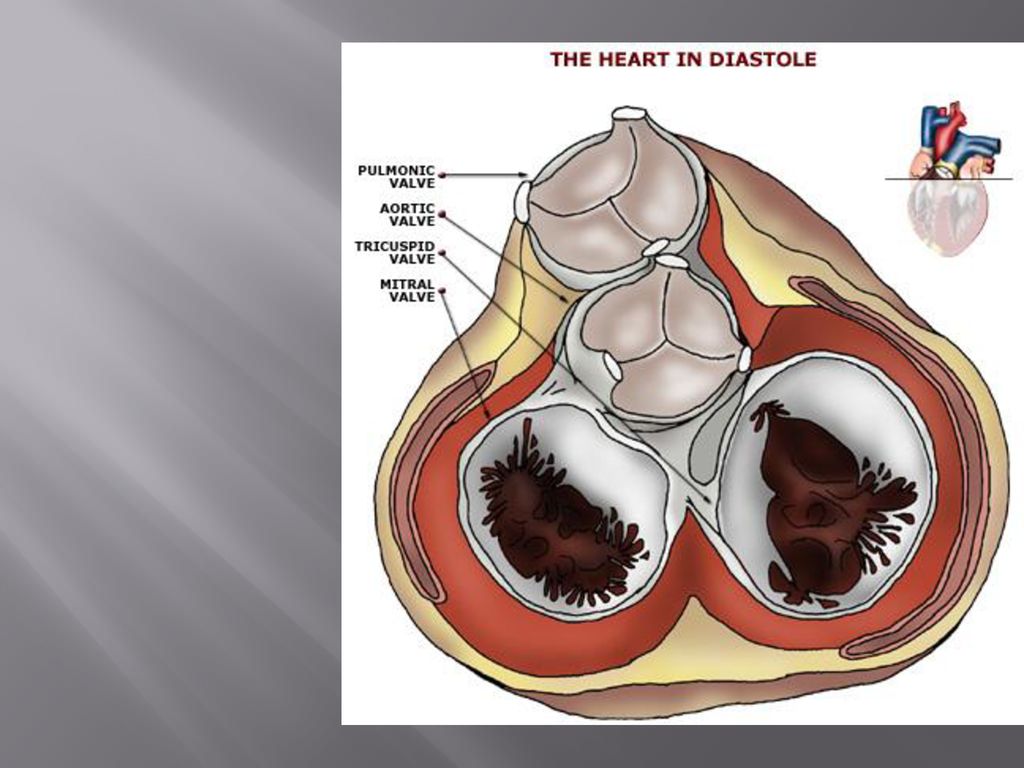 Поражение митрального клапана. Клапаны сердца. Клапаны сердца анатомия. Аортальный клапан человека.