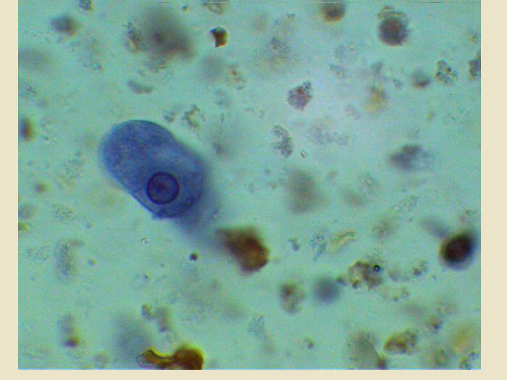 Заболевания вызванные амебами. Трофозоиты Entamoeba histolytica. Entamoeba histolytica под микроскопом. Entamoeba histolytica заболевание.
