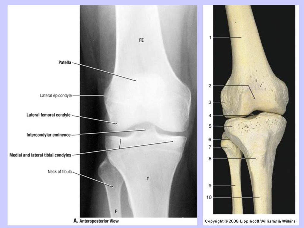 Bones of the lower limbs: os coxa (hip bone) femur patella tibia - ppt ...