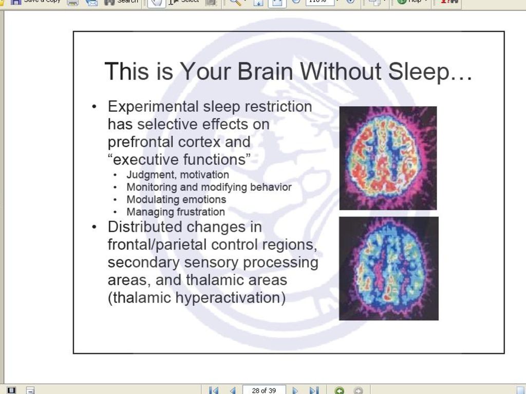 hipertenzija, poremećaji spavanja