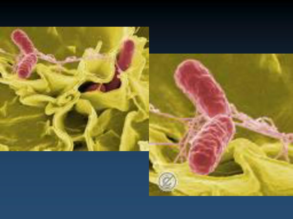 Salmonella and Salmonellosis - ppt download