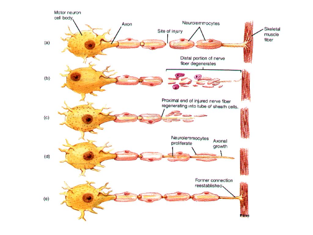 Дегенерация клеток. Регенерация нервного волокна схема. Регенерация нервных волокон после повреждения. Дегенерация периферического нерва. Регенерация нейронов гистология схема.