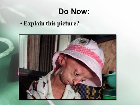 Do Now: Explain this picture?. Do Now part II: Brad Pitt's role in The Curious Case of Benjamin Button was based on a real life medical condition. Progeria,