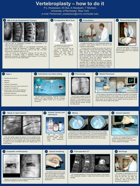 Vertebroplasty – how to do it P-L Westesson, M Oka, A Hiwatashi, T Moritani, University of Rochester, New York