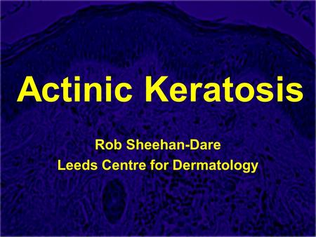 Rob Sheehan-Dare Leeds Centre for Dermatology