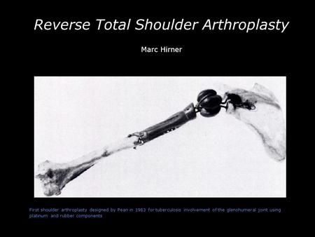 -- First shoulder arthroplasty