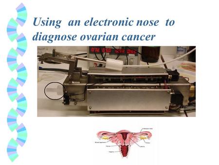 Using an electronic nose to diagnose ovarian cancer.