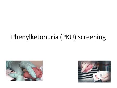 Phenylketonuria (PKU) screening. Pre-activity assessment questions Note: The first two slides are intended for first-time clicker users to become accustomed.