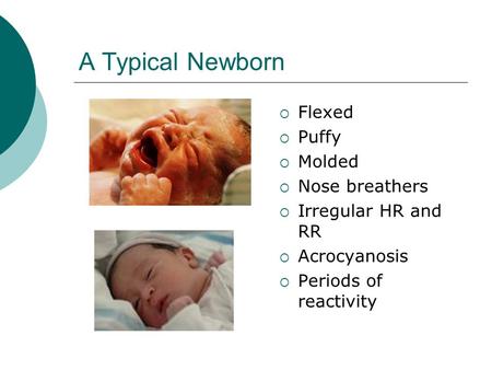 A Typical Newborn  Flexed  Puffy  Molded  Nose breathers  Irregular HR and RR  Acrocyanosis  Periods of reactivity.