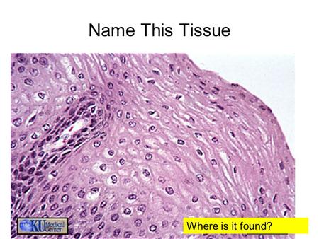 Name This Tissue Found in the skinWhere is it found?