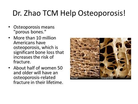 Dr. Zhao TCM Help Osteoporosis!