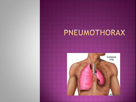 Pneumothorax.