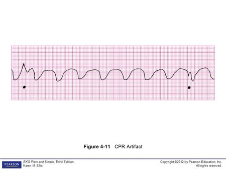 Copyright ©2012 by Pearson Education, Inc. All rights reserved. EKG Plain and Simple, Third Edition Karen M. Ellis Figure 4-11 CPR Artifact.
