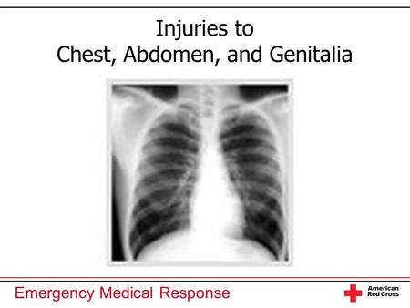 Injuries to Chest, Abdomen, and Genitalia