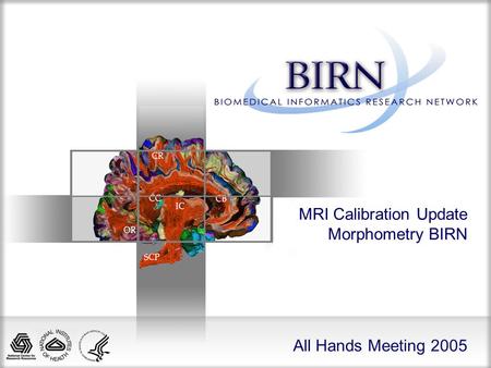 All Hands Meeting 2005 MRI Calibration Update Morphometry BIRN.