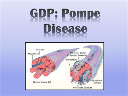 What is Pompe Disease? What does it look like?