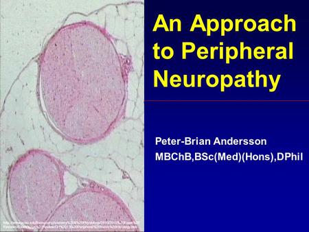 An Approach to Peripheral Neuropathy