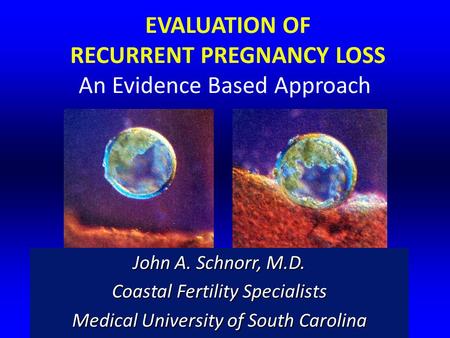 RECURRENT PREGNANCY LOSS