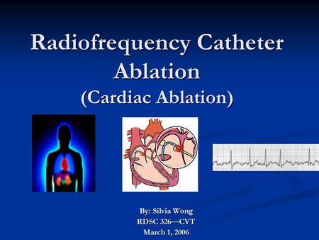 Radiofrequency Catheter Ablation (Cardiac Ablation) By: Silvia Wong RDSC 326—CVT March 1, 2006.