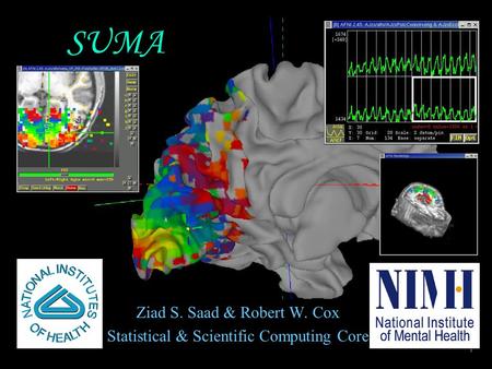 SUMA Ziad S. Saad & Robert W. Cox Statistical & Scientific Computing Core.