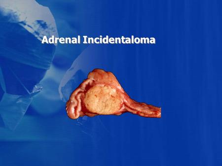 Adrenal Incidentaloma