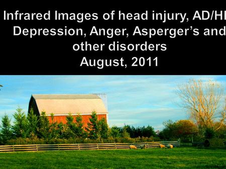Infrared Images of head injury, AD/HD, Depression, Anger, Asperger’s and other disorders August, 2011.