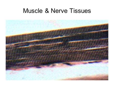 Muscle & Nerve Tissues. skeletal muscle, 10X, voluntary, striated attached to bones.