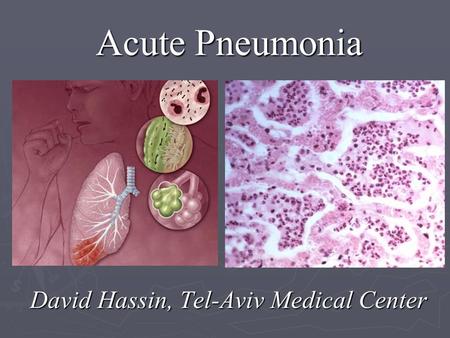Acute Pneumonia David Hassin, Tel-Aviv Medical Center.