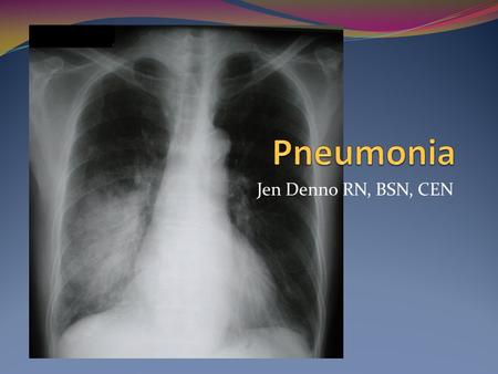 Pneumonia Jen Denno RN, BSN, CEN.