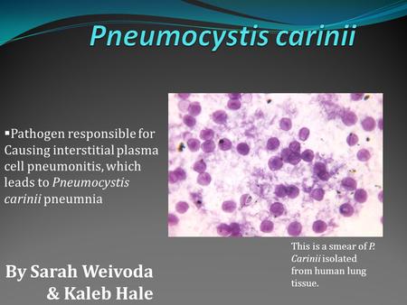 By Sarah Weivoda & Kaleb Hale This is a smear of P. Carinii isolated from human lung tissue.  Pathogen responsible for Causing interstitial plasma cell.