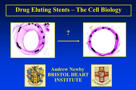 Drug Eluting Stents – The Cell Biology Andrew Newby BRISTOL HEART INSTITUTE ?