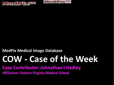 MedPix Medical Image Database COW - Case of the Week Case Contributor: Johnathan l Hadley Affiliation: Eastern Virginia Medical School.