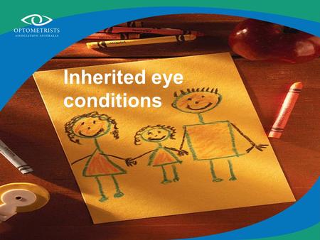 Inherited eye conditions. Some eye problems can run in the family Refractive error –Myopia –Hyperopia –Astigmatism Strabismus Retinitis pigmentosa Colour.