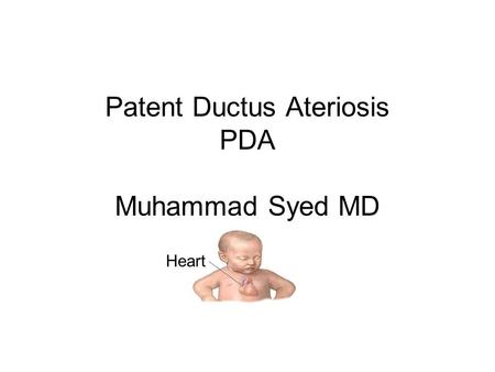 Patent Ductus Ateriosis PDA Muhammad Syed MD Heart.
