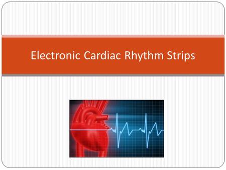 Electronic Cardiac Rhythm Strips. Electronic Cardiac Rhythm Strips an Overview  Cardiac rhythm strips are available immediately in StarPanel, eliminating.