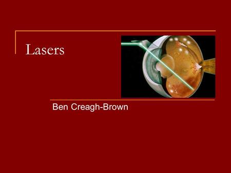 Lasers Ben Creagh-Brown. Beware Pay attention – there are MCQs at the end!