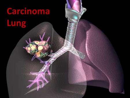 Carcinoma Lung.