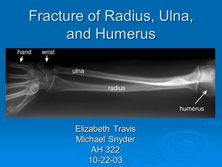 Fracture of Radius, Ulna, and Humerus