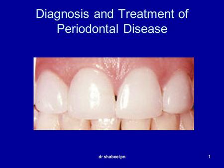 Diagnosis and Treatment of Periodontal Disease