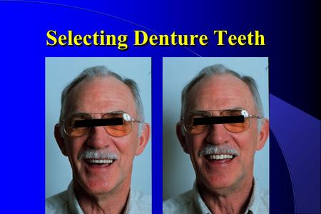 Selecting Denture Teeth