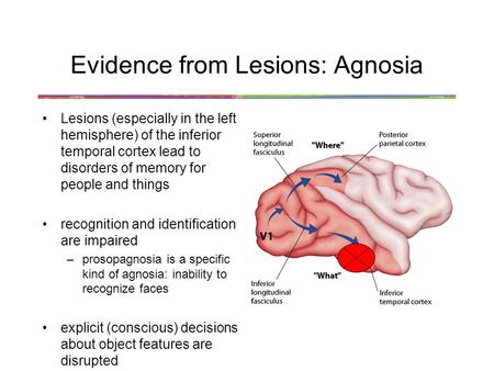 Evidence from Lesions: Agnosia Lesions (especially in the left hemisphere) of the inferior temporal cortex lead to disorders of memory for people and things.