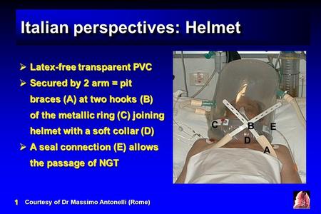 11 Italian perspectives: Helmet Courtesy of Dr Massimo Antonelli (Rome)  Latex-free transparent PVC  Secured by 2 arm = pit braces (A) at two hooks (B)