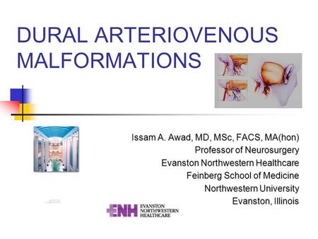 DURAL ARTERIOVENOUS MALFORMATIONS Issam A. Awad, MD, MSc, FACS, MA(hon) Professor of Neurosurgery Evanston Northwestern Healthcare Feinberg School of Medicine.