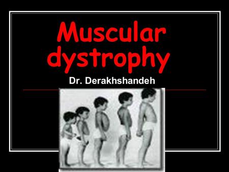 Muscular dystrophy Dr. Derakhshandeh. Muscular dystrophy Muscular dystrophy (MD) is a group of rare inherited muscle diseases in which muscle fibers are.