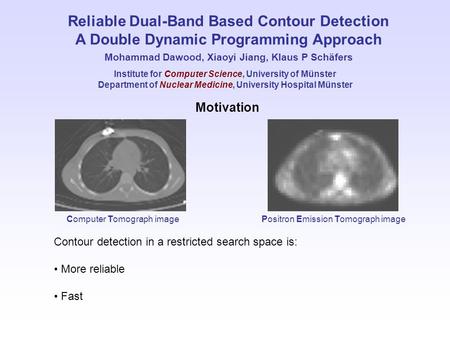 Reliable Dual-Band Based Contour Detection A Double Dynamic Programming Approach Mohammad Dawood, Xiaoyi Jiang, Klaus P Schäfers Motivation Contour detection.