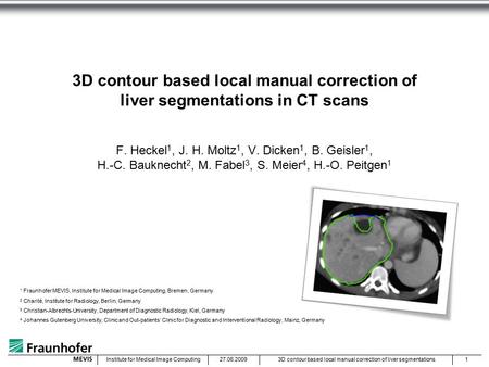 27.06.20093D contour based local manual correction of liver segmentations1Institute for Medical Image Computing 3D contour based local manual correction.